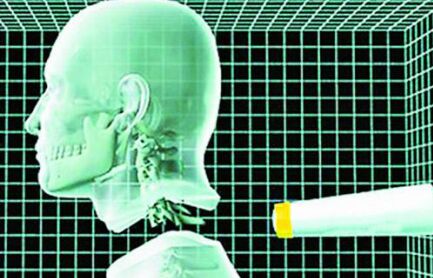 意科学家宣布两年内进行世界第一例人头移植手术